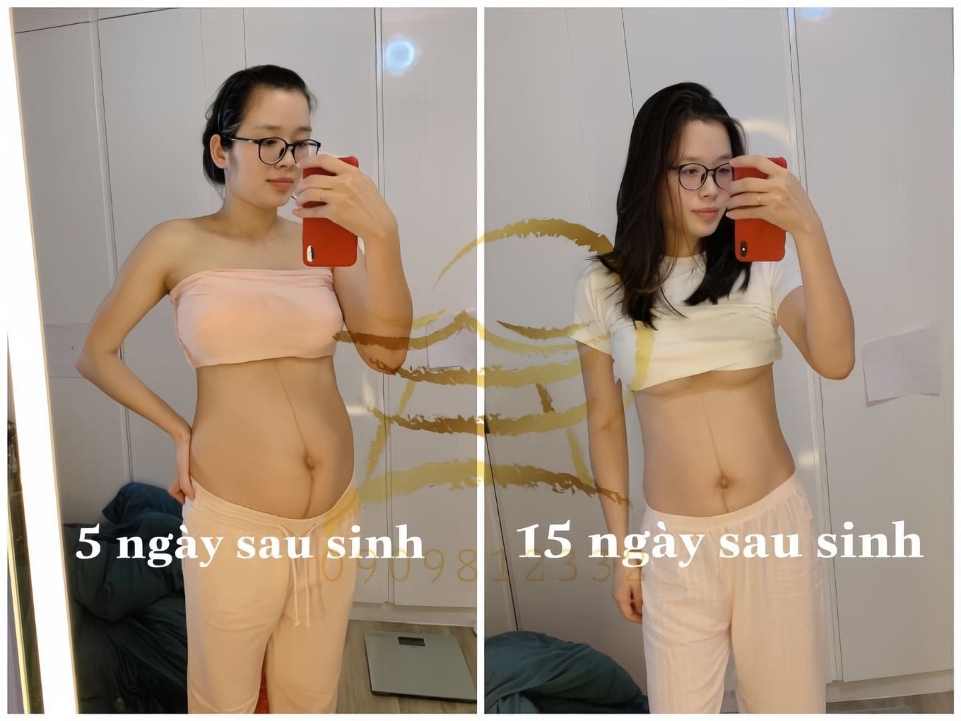 Mẹ sau sinh giảm eo sau 15 ngày sử dụng cao gừng